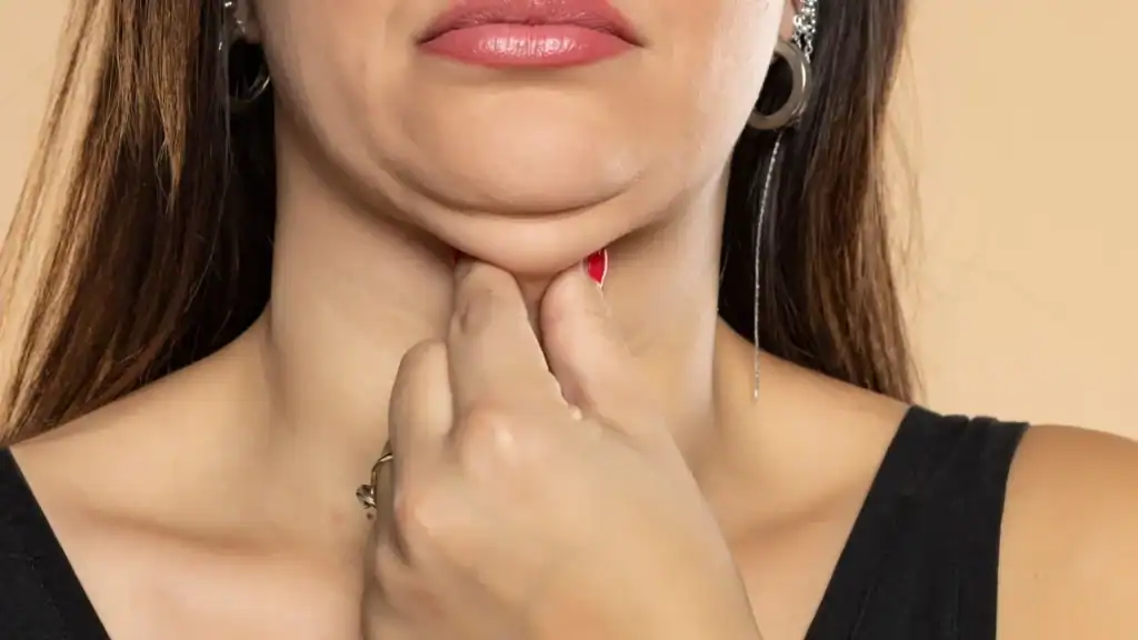 An image of a woman with double chin, sad, worried : Non Surgical Double Chin Removal Treatment in Newport, UK