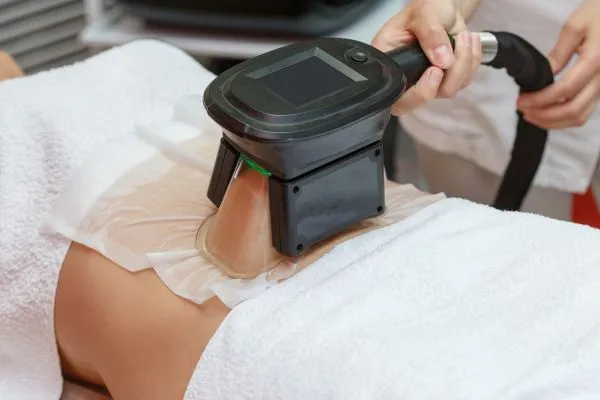 Image of person having fat freezing treatment to help weight gain Newport