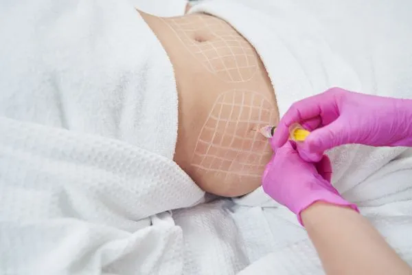 image of fat dissolving injections on love handles to help combat weight gain Newport