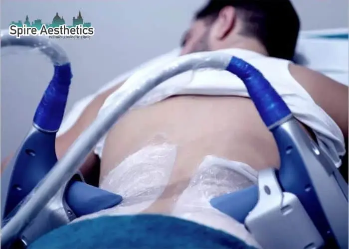 Man having fat freezing treatment done on love handles before a competitions Newport to create a sculpted look.