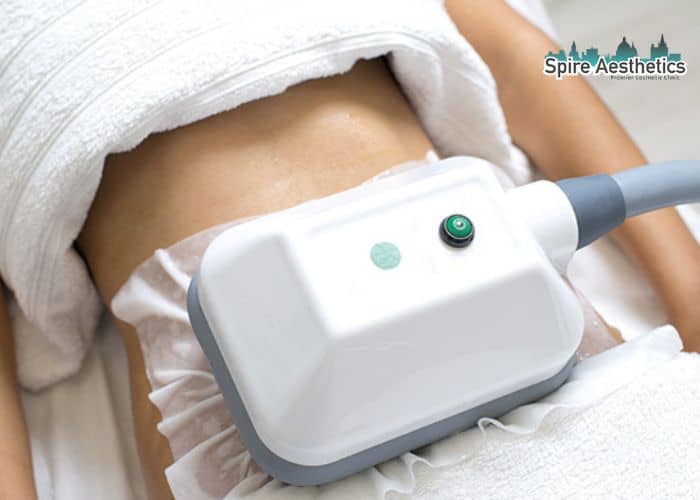 Shift Those Extra Pounds: How Fat Freezing Can Help You Slim Down Newport