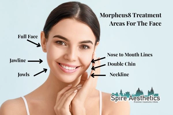 Where can Morpheus8 Treatment Newport be done on the body?
