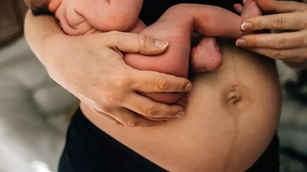 Why Is My Stomach Still Big After Pregnancy Newport?